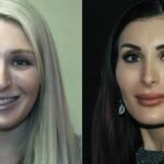 Laura Loomer Plastic Surgery Before & After Transformation, Rumors, and the Truth