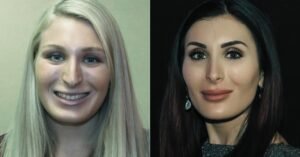 Laura Loomer Plastic Surgery Before & After Transformation, Rumors, and the Truth